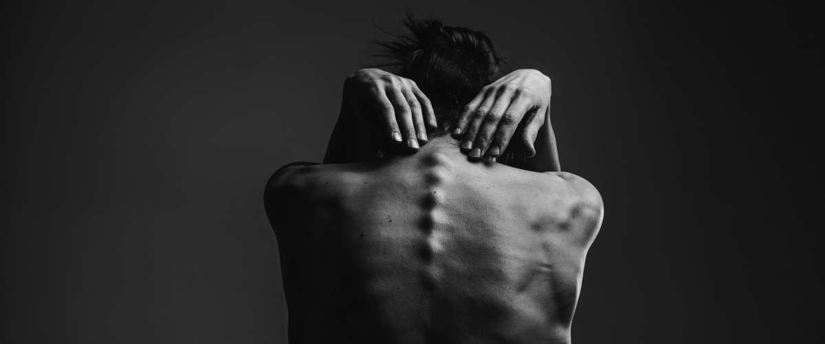 Anorexia and bulimia concept
