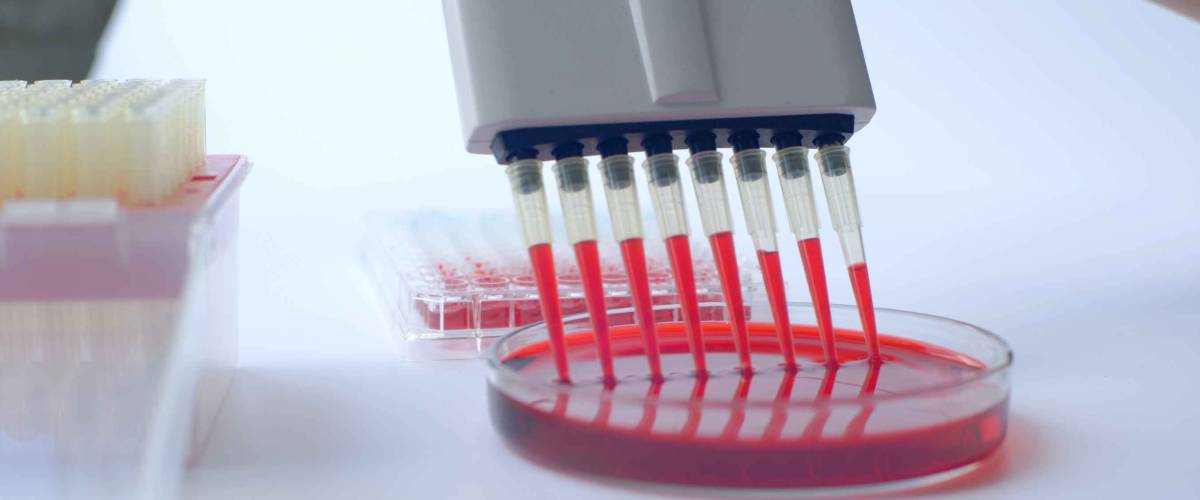 Scientist working with multichannel pipette.