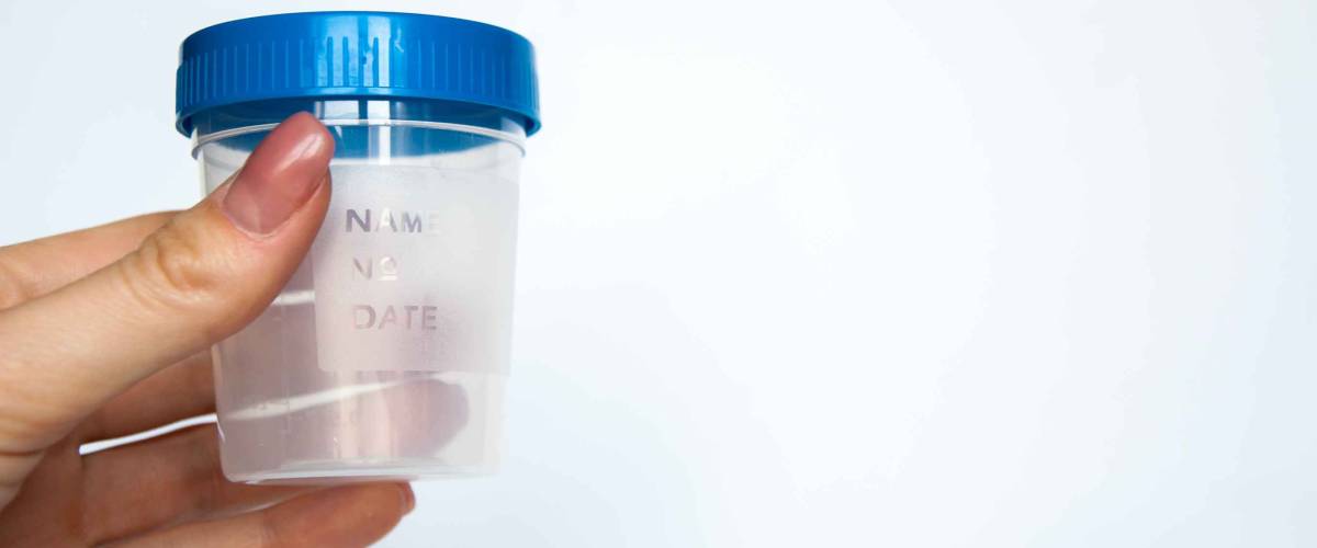 plastic bottle for delivery of urine.