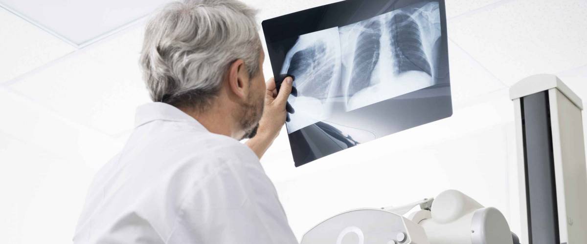 Male Doctor Analyzing Chest X-ray In Examination Room