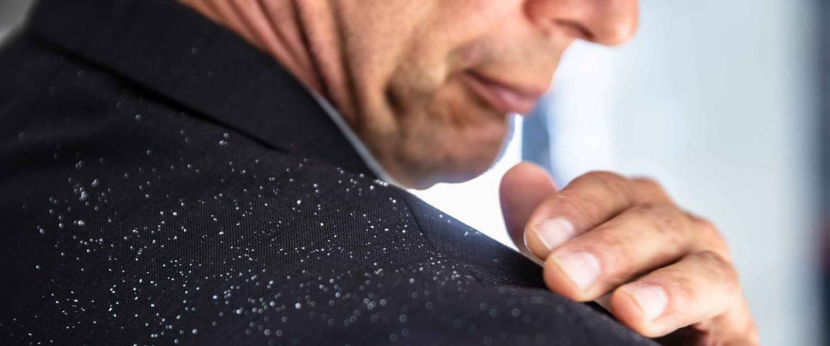 Close-up of a man's hand brushing off fallen dandruff on shoulder