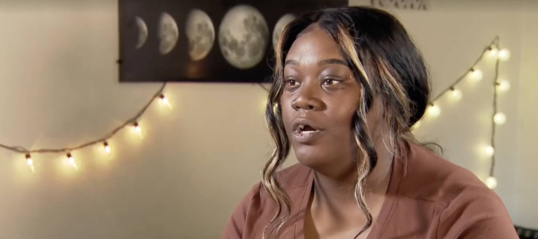 Houston woman's discusses her severe dental issues