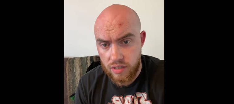 Bald, serious looking man stares directly at camera.