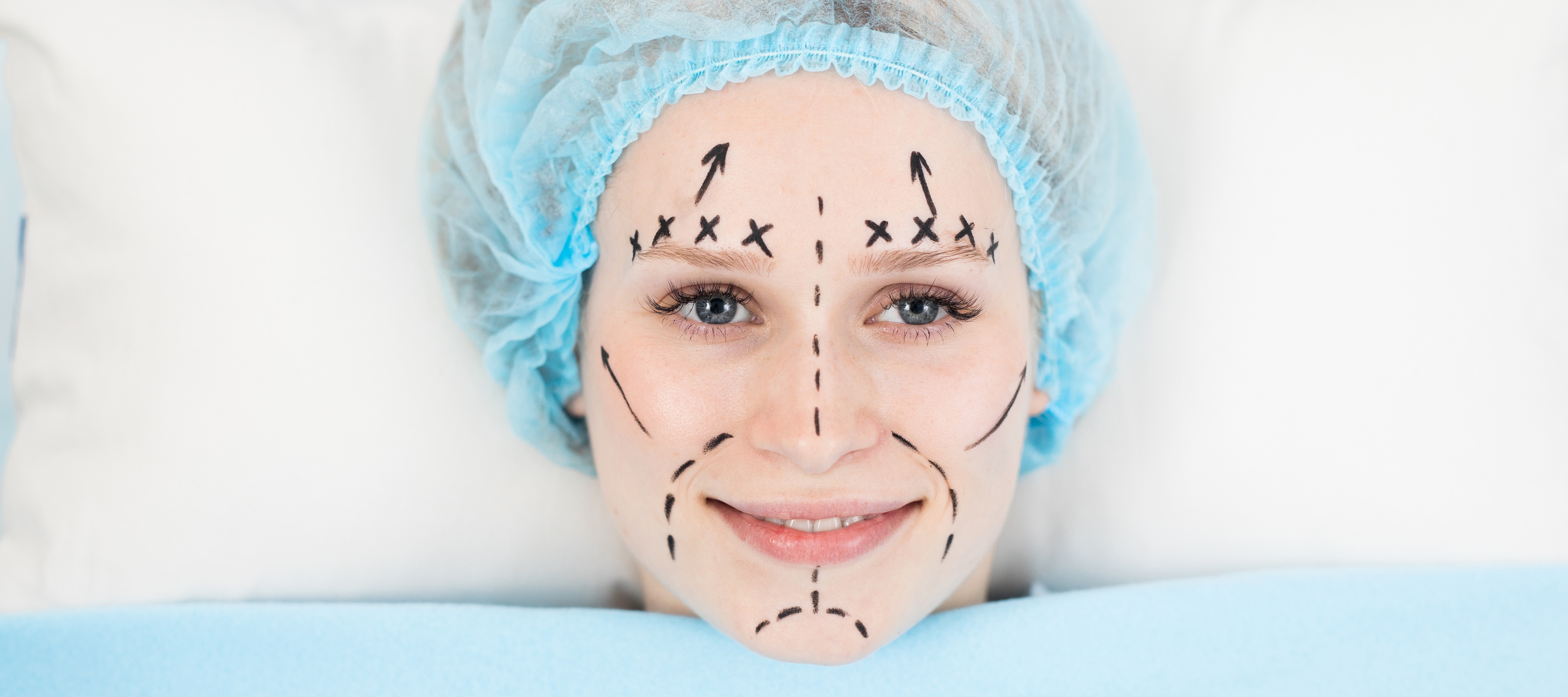 A woman smiles with surgical guide marks drawn on her face and a hairnet while under a blanket on an operating table.