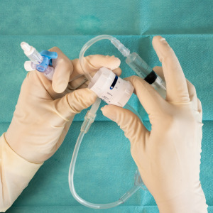 A nurse administering an epidural.